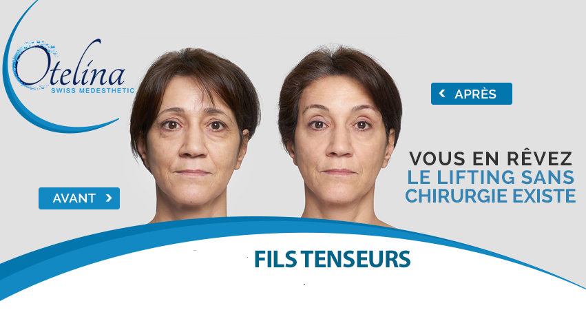 fils-tenseurs-5825146